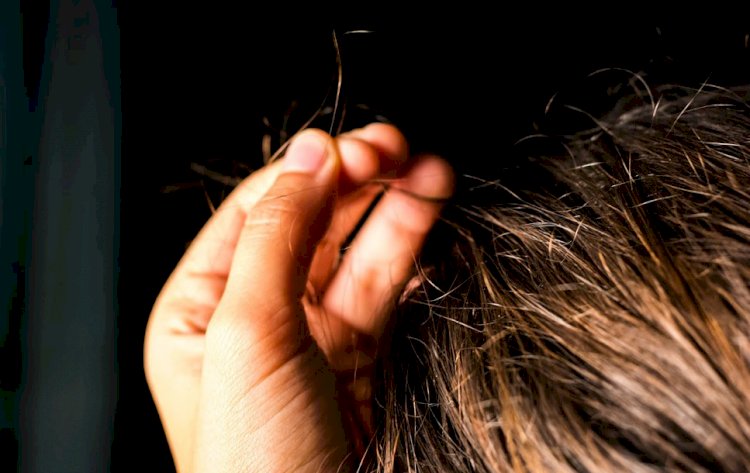 Trichotillomania is a condition in which people pull their hair out. It may be hair on the head or hair in other places, such as the eyebrows or eyelashes.